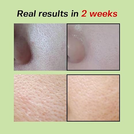 (Sérum minizador de poros) SUNGBOON EDITOR Green Tomato Pore Lifting Ampoule+ 30ml