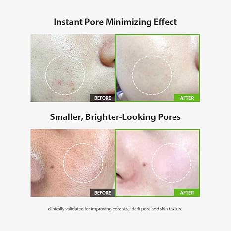 (Sérum minizador de poros) SUNGBOON EDITOR Green Tomato Pore Lifting Ampoule+ 30ml