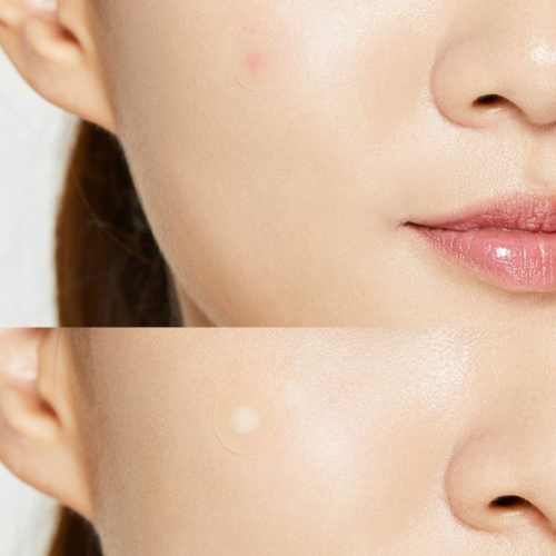 (Parche para acné) COSRX Acne Pimple Master 24 patches