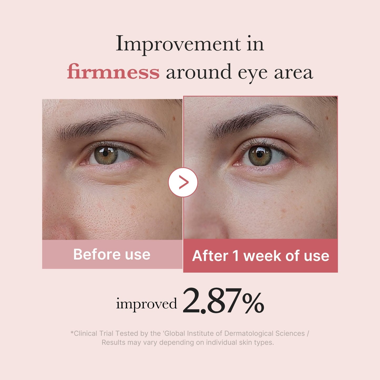 (Sérum contorno de ojos) Medicube PDRN Pink Eye Serum 30ml
